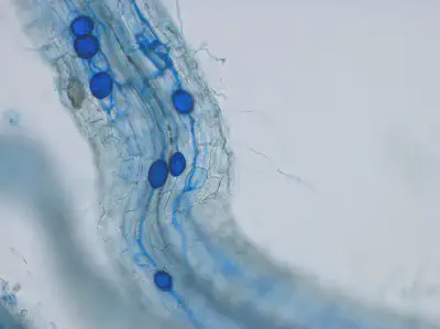 Fig.6: Dyed arbuscular mycorrhizal fungi (AMF) under the microscope
