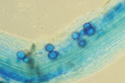 Fig.7: Dyed arbuscular mycorrhizal fungi (AMF) under the microscope